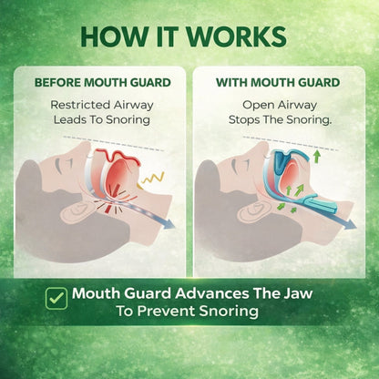 Veroa™ Anti-Snoring Mouthpiece